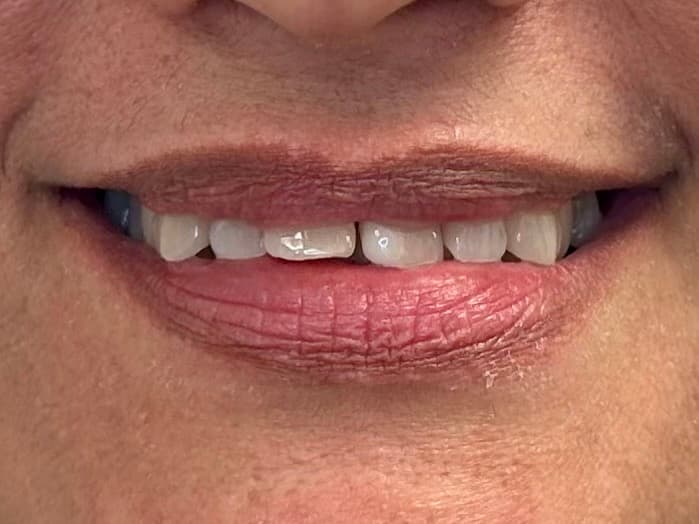 Case 01, before treatment