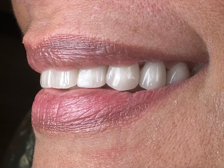 Case 01, after treatment, additional view 1