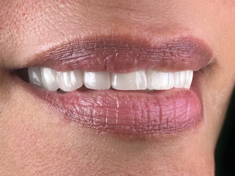Case 01, after treatment, additional view 2